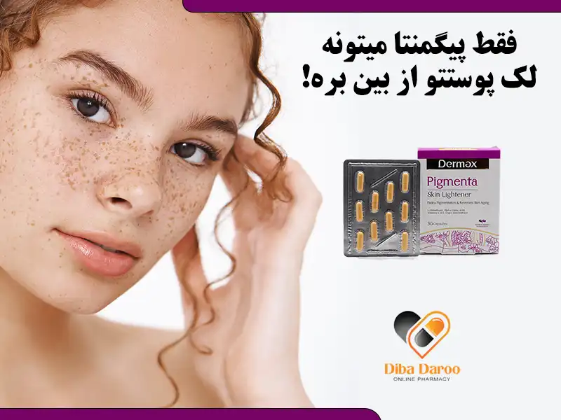ذبیابایس