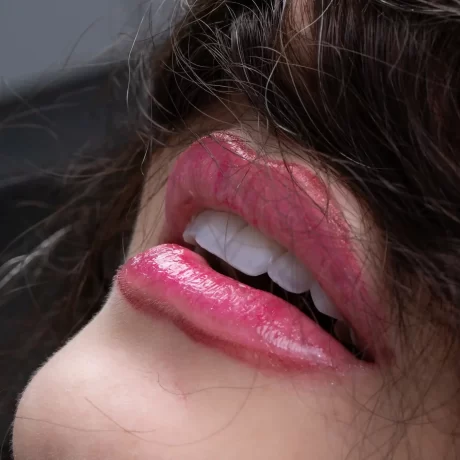 کامپوزیت دندان و مراقبت های ان